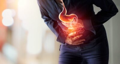 Reflux, inflammation of the bowel