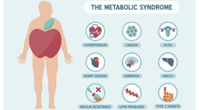 metabolický syndróm