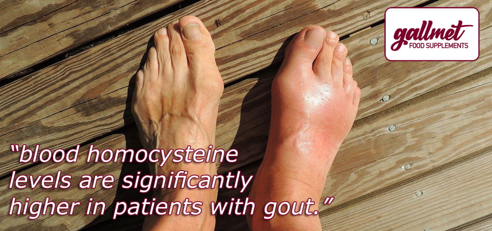 blood homocysteine levels are significantly higher in patients with gout
