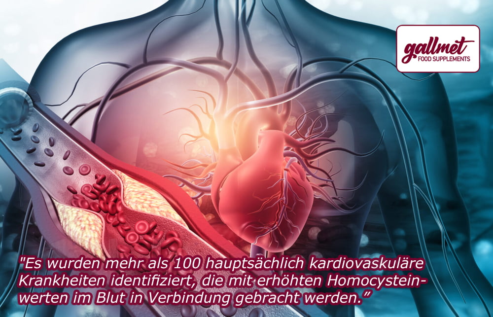 Es wurden mehr als 100 Krankheiten identifiziert, die mit einem erhöhten Homocysteinspiegel im Blut einhergehen.
