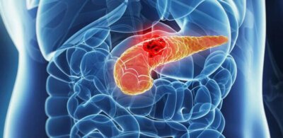 pancreatitis, pancreatic insufficiency